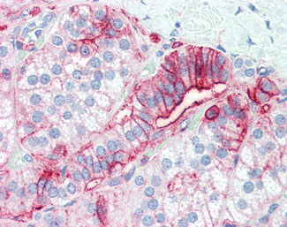 IHC - CD44 Antibody (clone MEM-85) ALS12664